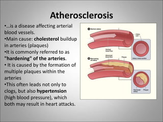 Atherosclerosis
•…is a disease affecting arterial
blood vessels.
•Main cause: cholesterol buildup
in arteries (plaques)
•It is commonly referred to as
"hardening" of the arteries.
• It is caused by the formation of
multiple plaques within the
arteries
•This often leads not only to
clogs, but also hypertension
(high blood pressure), which
both may result in heart attacks.
 