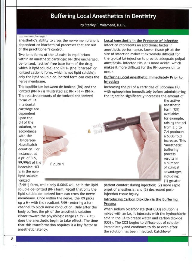 Buffering Local Anesthesia PDF