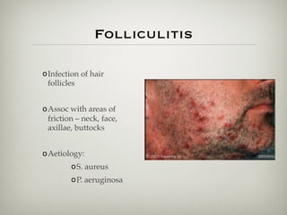 Folliculitis
oInfection of hair
follicles
oAssoc with areas of
friction – neck, face,
axillae, buttocks
oAetiology:
oS. aureus
oP. aeruginosa
 