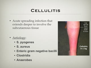 Cellulitis
• Acute spreading infection that
extends deeper to involve the
subcutaenous tissue
• Aetiology:
• S. pyogenes
• S. aureus
• Enteric gram negative bacilli
• Clostridia
• Anaerobes
 