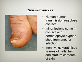Dermatophyes:
• Human-human
transmission req close
contact
• minor lesions come in
contact with
dermatophyte hyphae
shed from another
infection.
• non-living, keratinised
tissues of nails, hair
and stratum corneum
of skin
 