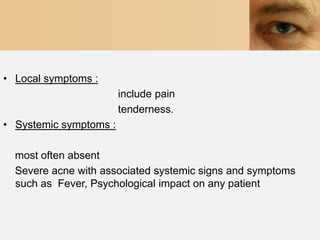 • Local symptoms :
                        include pain
                        tenderness.
• Systemic symptoms :

  most often absent
  Severe acne with associated systemic signs and symptoms
  such as Fever, Psychological impact on any patient
 