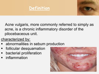 Definition


  Acne vulgaris, more commonly referred to simply as
  acne, is a chronic inflammatory disorder of the
  pilocebaceous unit.
characterized by:
 abnormalities in sebum production
 follicular desquamation
 bacterial proliferation
 inflammation
 