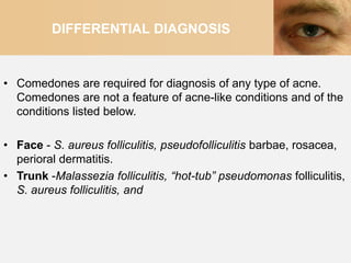 DIFFERENTIAL DIAGNOSIS


• Comedones are required for diagnosis of any type of acne.
  Comedones are not a feature of acne-like conditions and of the
  conditions listed below.

• Face - S. aureus folliculitis, pseudofolliculitis barbae, rosacea,
  perioral dermatitis.
• Trunk -Malassezia folliculitis, “hot-tub” pseudomonas folliculitis,
  S. aureus folliculitis, and
 