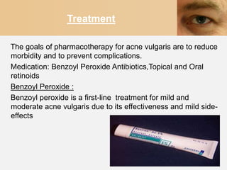 Treatment

The goals of pharmacotherapy for acne vulgaris are to reduce
morbidity and to prevent complications.
Medication: Benzoyl Peroxide Antibiotics,Topical and Oral
retinoids
Benzoyl Peroxide :
Benzoyl peroxide is a first-line treatment for mild and
moderate acne vulgaris due to its effectiveness and mild side-
effects
 