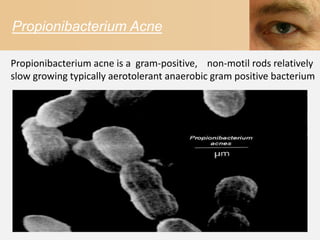 Propionibacterium Acne

Propionibacterium acne is a gram-positive, non-motil rods relatively
slow growing typically aerotolerant anaerobic gram positive bacterium
 