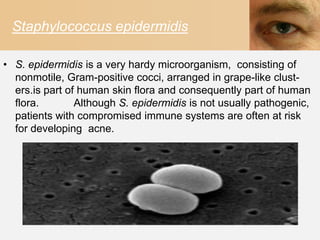 Staphylococcus epidermidis

• S. epidermidis is a very hardy microorganism, consisting of
  nonmotile, Gram-positive cocci, arranged in grape-like clust-
  ers.is part of human skin flora and consequently part of human
  flora.        Although S. epidermidis is not usually pathogenic,
  patients with compromised immune systems are often at risk
  for developing acne.
 