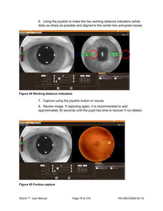 D-Solix-User-Manual_optovue_ophthalmology | PDF
