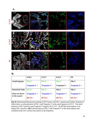 34
E10.5 E12.5 E14.5 P0
Atrial Septum Flk-1+
Troponin T +
Flk-1+
Troponin T +
Flk-1+
Troponin T -
Flk-1-
Troponin T +
Sionatrial Node
(Data not shown
in this report)
Flk-1+
Troponin T +
HCN4 +
Flk-1+
Troponin T +
HCN4 +
Flk-1-
Troponin T +
HCN4 +
Flk-1-
Troponin T +
HCN4 +
Fig 10. (A) Immunoflourescent staining of WT hearts with Flk-1 (green) and cardiac Troponin T
(blue) show a collocalization of Flk-1 and Troponin T in the atrail spetum in E12.5. The atrial
sepctum is Flk-1 positive and Troponin T negative by E 14.5. By P0 the atrial septum is no
longer Flk-1 positive. (B) Collocalization of Flk-1 and Troponin T in the atrial spetum and
sionatrial node over various time points in development.
Merged Flk-1 Troponin T
E12.5E14.5P0 A.
B.
 