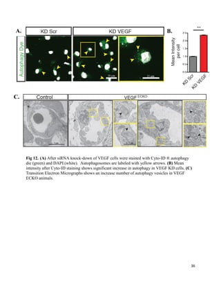 36
Fig 12. (A) After siRNA knock-down of VEGF cells were stained with Cyto-ID ® autophagy
die (green) and DAPI (white). Autophagosomes are labeled with yellow arrows. (B) Mean
intensity after Cyto-ID staining shows significant increase in autophagy in VEGF KD cells. (C)
Transition Electron Micrographs shows an increase number of autophagy vesicles in VEGF
ECKO animals.
A.
B.A.
C.
.
 