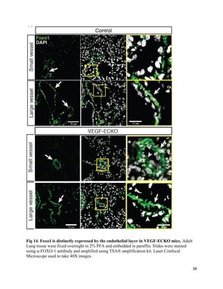 38
Fig 14. Foxo1 is distinctly expressed by the endothelial layer in VEGF-ECKO mice. Adult
Lung tissue were fixed overnight in 2% PFA and embedded in paraffin. Slides were stained
using α-FOXO-1 antibody and amplified using TSA® amplification kit. Laser Confocal
Microscope used to take 40X images.
 