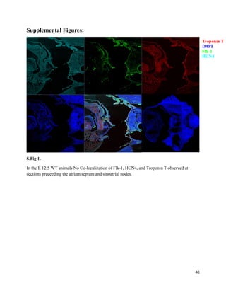 40
Supplemental Figures:
S.Fig 1.
In the E 12.5 WT animals No Co-localization of Flk-1, HCN4, and Troponin T observed at
sections preceeding the atriam septum and sinoatrial nodes.
 