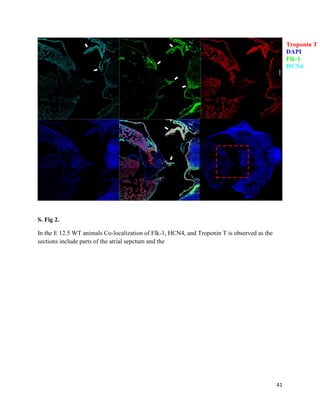 41
S. Fig 2.
In the E 12.5 WT animals Co-localization of Flk-1, HCN4, and Troponin T is observed as the
sections include parts of the atrial sepctum and the
Troponin T
DAPI
Flk-1
HCN4
 
