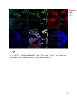 42
Troponin T
DAPI
Flk-1
HCN4
S. Fig 3.
In the E 12.5 WT animals Co-localization of Flk-1, HCN4, and Troponin T is not observed at
the preferial regions of the atrial septum but only towards the center.
 