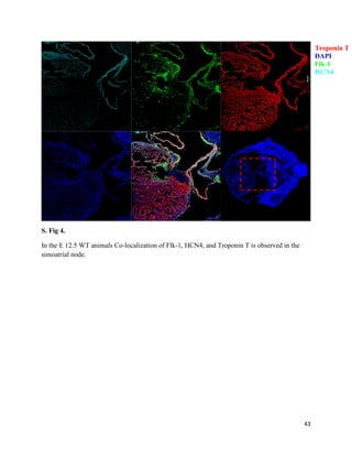 43
S. Fig 4.
In the E 12.5 WT animals Co-localization of Flk-1, HCN4, and Troponin T is observed in the
simoatrial node.
Troponin T
DAPI
Flk-1
HCN4
 