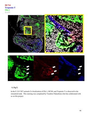 44
S. Fig 5.
In the E 10.5 WT animals Co-localization of Flk-1, HCN4, and Troponin T is observed in the
simoatrial node. This staining was completed by Yasuhiro Nakashima who has colaborated with
us on this project.
HCN4
Troponin T
Flk-1
DAPI
 
