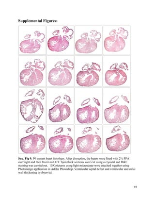 49
Supplemental Figures:
Sup. Fig 9. P0 mutant heart histology. After dissection, the hearts were fixed with 2% PFA
overnight and then frozen in OCT. 8µm thick sections were cut using a cryostat and H&E
staining was carried out. 10X pictures using light microscope were attached together using
Photomerge application in Adobe Photoshop. Ventricular septal defect and ventricular and atrial
wall thickening is observed.
 