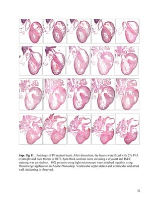 51
Sup. Fig 11. Histology of P0 mutant heart. After dissection, the hearts were fixed with 2% PFA
overnight and then frozen in OCT. 8µm thick sections were cut using a cryostat and H&E
staining was carried out. 10X pictures using light microscope were attached together using
Photomerge application in Adobe Photoshop. Ventricular septal defect and ventricular and atrial
wall thickening is observed.
 