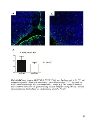 27
Fig 3. (A-B) Tumor tissue (a, VEGF WT, b: VEGF ECKO) were fixed overnight in 2% PFA and
embedded in paraffin. Slides were stained using Upstate Biotechnology TUNEL apoptosis kit.
Laser Confocal Microscope used to take 4x4 tiled 40X images. (C) Total number of apoptotic
nuclei over total tumor area was quantified using ImageJ® image processing software. Graphical
representation and statistical analysis was done using GraphPad Prism®.
A. B.
C.
 