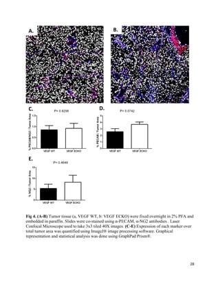 28
Fig 4. (A-B) Tumor tissue (a, VEGF WT, b: VEGF ECKO) were fixed overnight in 2% PFA and
embedded in paraffin. Slides were co-stained using α-PECAM, α-NG2 antibodies . Laser
Confocal Microscope used to take 3x3 tiled 40X images. (C-E) Expression of each marker over
total tumor area was quantified using ImageJ® image processing software. Graphical
representation and statistical analysis was done using GraphPad Prism®.
A. B.
C. D.
E.
 
