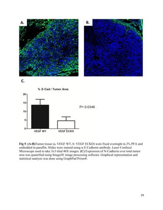 29
Fig 5. (A-B)Tumor tissue (a, VEGF WT, b: VEGF ECKO) were fixed overnight in 2% PFA and
embedded in paraffin. Slides were stained using α-E Cadherin antibody. Laser Confocal
Microscope used to take 3x3 tiled 40X images. (C) Expression of N-Cadherin over total tumor
area was quantified using ImageJ® image processing software. Graphical representation and
statistical analysis was done using GraphPad Prism®.
A. B.
C.
 