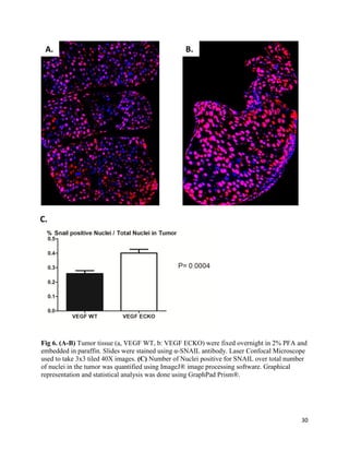 30
Fig 6. (A-B) Tumor tissue (a, VEGF WT, b: VEGF ECKO) were fixed overnight in 2% PFA and
embedded in paraffin. Slides were stained using α-SNAIL antibody. Laser Confocal Microscope
used to take 3x3 tiled 40X images. (C) Number of Nuclei positive for SNAIL over total number
of nuclei in the tumor was quantified using ImageJ® image processing software. Graphical
representation and statistical analysis was done using GraphPad Prism®.
A. B.
C.
 