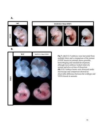 31
WT
E12.5
Sm22:Cre+ Rosa-VEGF+
WT Sm22:Cre+ Rosa-VEGF+
E10.5
Fig 7. (A) E12.5 embryos were harvested from
multiple litters and a comparison of the mutant
(VEGF knock-in) animals shows possible
hemorrhaging and retarded development,
although most embryos looked relatively
normal and alive at time of dissection
(B) E10.5 embryo hearts were dissected under
microscope and comparison showed no
observable difference between the wildtype and
VEFG knock-in animals.
A.
B.
 