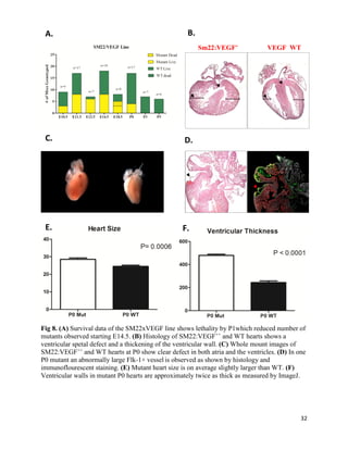 32
Fig 8. (A) Survival data of the SM22xVEGF line shows lethality by P1which reduced number of
mutants observed starting E14.5. (B) Histology of SM22:VEGF++
and WT hearts shows a
ventricular spetal defect and a thickening of the ventricular wall. (C) Whole mount images of
SM22:VEGF++
and WT hearts at P0 show clear defect in both atria and the ventricles. (D) In one
P0 mutant an abnormally large Flk-1+ vessel is observed as shown by histology and
immunoflourescent staining. (E) Mutant heart size is on average slightly larger than WT. (F)
Ventricular walls in mutant P0 hearts are approximately twice as thick as measured by ImageJ.
VEGF WTSm22:VEGF+
+
A. B.
C. D.
E. F.
 