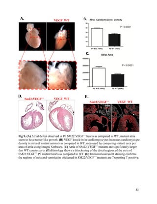 33
Fig 9. (A) Atrial defect observed in P0 SM22:VEGF++
hearts as compared to WT, mutant atria
seem to have tumor like growth. (B) VEGF knock-in in cardiomycocytes increases cardiomyocyte
density in atria of mutant animals as compared to WT, measured by comparing stained area per
area of atria using ImageJ Software. (C) Atria of SM22:VEGF++
mutants are significantly larger
that WT counterparts. (D) Histology shows a thinckening of the distal regions of the atria of
SM22:VEGF++
P0 mutant hearts as compared to WT. (E) Immunoflourescent staining confirms
the regions of atria and ventricules thickened in SM22:VEGF++
mutants are Troponing T positive.
VEGF WT
DAPI
Trp T
Sm22:VEGF++ VEGF WT
A.
D. E.VEGF WTSm22:VEGF++
A. B.
C.
 