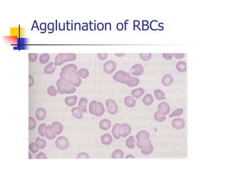 Classifications of anemias 5830599.ppt