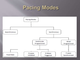 Pacemaker For Algorithm pacemaker | PPT