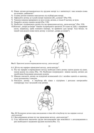 4) Ніжки дитини розташовуються під грудьми матері та є напівзігнуті: така позиція схожа
    на позицію „жабенятко”.
5) Голівка дитини повинна знаходитись під підборіддям матері.
6) Зафіксуйте дитину до тулуба матері тканиною або „сумкою” (Рис.9 В).
7) Тканина повинна прикривати не всю голову дитини, а тільки її частину до вуха.
8) Накрийте дитину одежею матері (Рис. 9 В).
9) Необхідно підтримувати дитину під час проведення методу „мати-кенгуру” (Рис. 9 В).
10) Контакт „шкіра-до-шкіри” бажано підтримувати протягом 24 годин на добу з перервами
    (коли, наприклад, треба поміняти памперс, чи прийняти душ матері. Тоді батько, чи
    інший член родити може взяти дитину в контакт „шкіра-до-шкіри”).




                       А                                          В
Рис.9. Практичні аспекти впровадження методу „мати-кенгуру”

6.4. Дії під час перерв в проведенні методу „мати-кенгуру”.
1) Під час перерви в впровадженні методу необхідно взяти дитину однією рукою під шию,
    іншою рукою під спину (Рис. 10). Необхідно підтримувати нижню щелепу дитини для
    запобігання блокування дихальних шляхів;
2) Швидко покладіть дитину на підігрітий пеленальний стіл і негайно одягніть в шапочку,
    теплу розпашонку і повзуни.
3) Покладіть дитину         в інкубатор або ліжко з підігрівом і ретельно контролюйте
    температуру тіла і загальний стан дитини.




Рис. 10. Положення дитини перед викладанням в ліжко або в інкубатор під час перерви в методі
„мати-кенгуру”
6.5. Вигодовування дитини під час проведення методу „мати-кенгуру”.
1) Слід забезпечити виключно грудне вигодовування при можливості з догодовуванням в
    разі необхідності зцідженим грудним молоком (Рис. 11).

                                               35
 