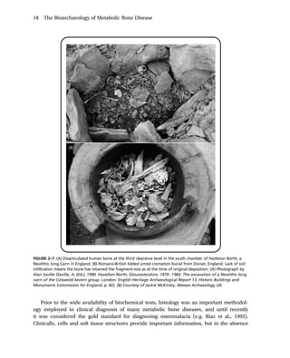 The Bioarchaeology Of Metabolic Bone Disease 2nd Edition Megan Brickley ...