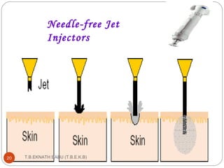 Needle-free Jet 
Injectors 
T.B.EKNATH 20 BABU (T.B.E.K.B) 
 