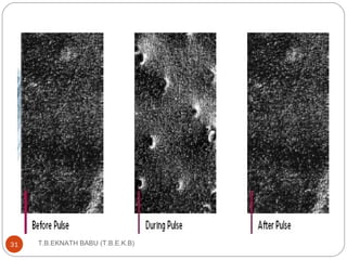 T.B.EKNATH 31 BABU (T.B.E.K.B) 
 