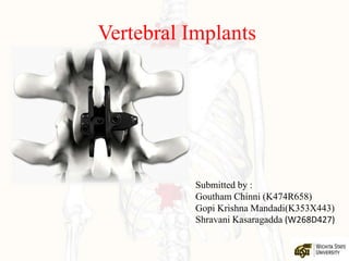 Vertebral Implants
Submitted by :
Goutham Chinni (K474R658)
Gopi Krishna Mandadi(K353X443)
Shravani Kasaragadda (W268D427)
 