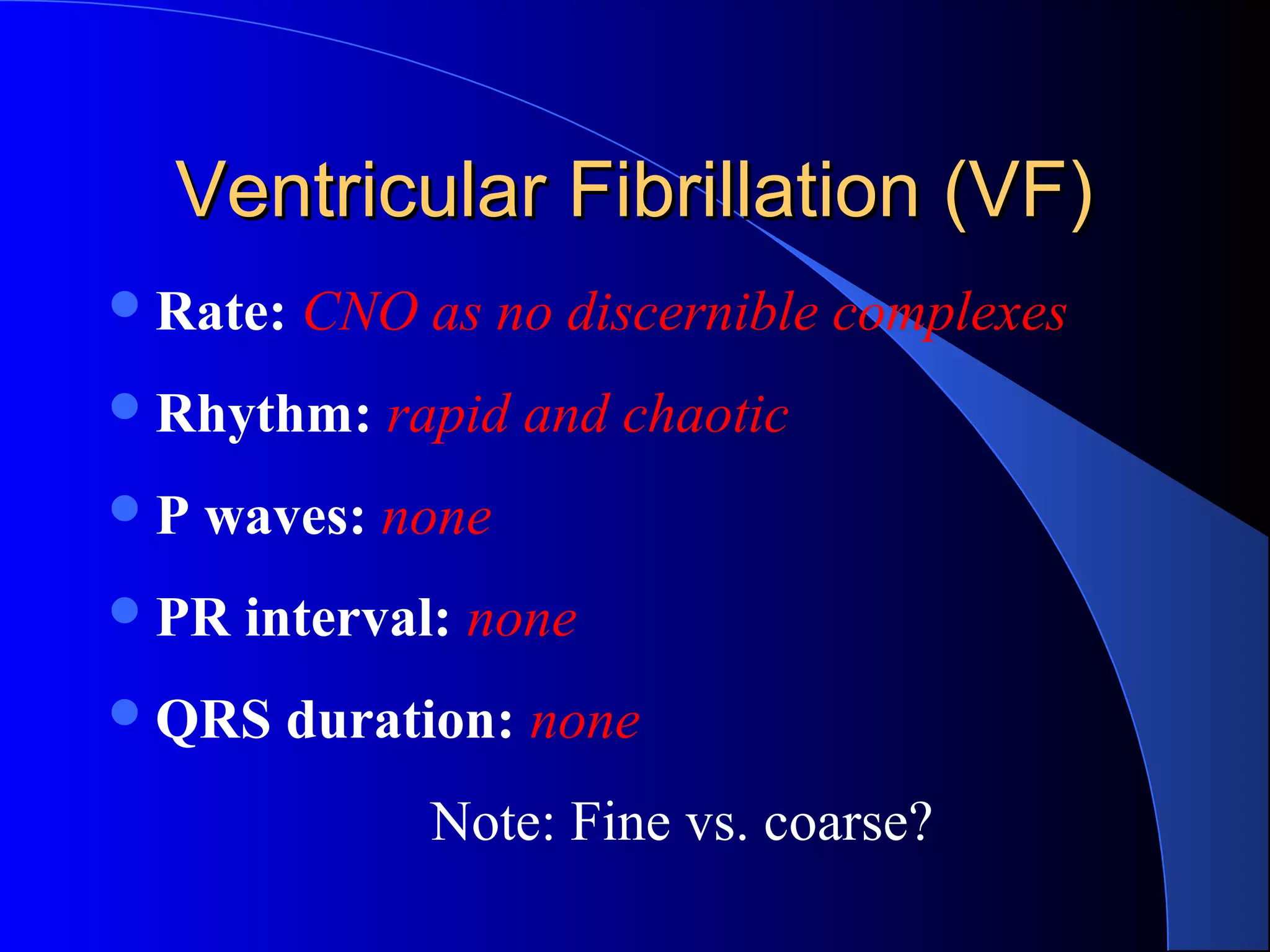 Ventricular Fibrillation (VF)
 Rate:

CNO as no discernible complexes

 Rhythm:
P

rapid and chaotic

waves: none

 PR

interval: none

 QRS

duration: none
Note: Fine vs. coarse?

 
