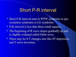 ECG | PPT