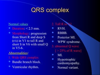 ECG | PPT