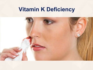 Vitamin K Deficiency
 