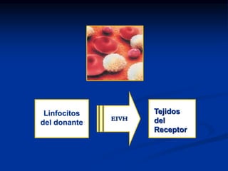 Linfocitos
del donante
Tejidos
del
Receptor
EIVH
 