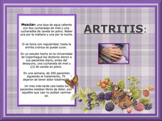 MezclarMezclar:: una taza de agua calienteuna taza de agua caliente
con dos cucharadas de miel y unacon dos cucharadas de miel y una
cucharadita de canela en polvo. Bebercucharadita de canela en polvo. Beber
una por la mañana y una por la noche.una por la mañana y una por la noche.
Si se toma con regularidad, hasta laSi se toma con regularidad, hasta la
artritis crónica se puede curar.artritis crónica se puede curar.
En un estudio hecho en la UniversidadEn un estudio hecho en la Universidad
de Copenhague los doctores dieron ade Copenhague los doctores dieron a
sus pacientes diario, antes delsus pacientes diario, antes del
desayuno, una cucharada de miel ydesayuno, una cucharada de miel y
1/2 de canela en polvo.1/2 de canela en polvo.
En una semana, de 200 pacientesEn una semana, de 200 pacientes
siguiendo el tratamiento, 75siguiendo el tratamiento, 75
dejaron de tener dolor totalmente.dejaron de tener dolor totalmente.
Un mes más tarde casi todos losUn mes más tarde casi todos los
pacientes estaban libres de dolor, aúnpacientes estaban libres de dolor, aún
aquellos que casi no podían caminaraquellos que casi no podían caminar
ya.ya.
ARTRITIS:
 