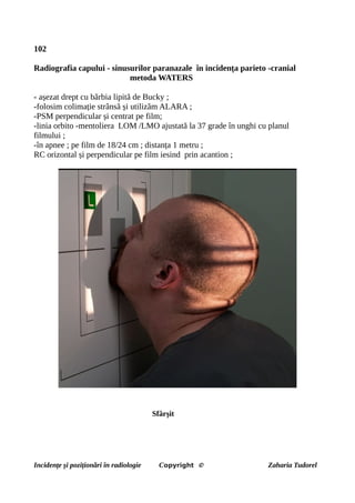 102
Radiografia capului - sinusurilor paranazale în incidența parieto -cranial
metoda WATERS
- așezat drept cu bărbia lipită de Bucky ;
-folosim colimație strânsă și utilizăm ALARA ;
-PSM perpendicular și centrat pe film;
-linia orbito -mentoliera LOM /LMO ajustată la 37 grade în unghi cu planul
filmului ;
-în apnee ; pe film de 18/24 cm ; distanța 1 metru ;
RC orizontal și perpendicular pe film iesind prin acantion ;
Sfârșit
Incidențe și poziționări în radiologie Copyright © Zaharia Tudorel
 