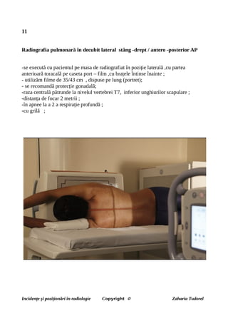 11
Radiografia pulmonară în decubit lateral stâng -drept / antero -posterior AP
-se execută cu pacientul pe masa de radiografiat în poziție laterală ,cu partea
anterioară toracală pe caseta port – film ,cu brațele întinse înainte ;
- utilizăm filme de 35/43 cm , dispuse pe lung (portret);
- se recomandă protecție gonadală;
-raza centrală pătrunde la nivelul vertebrei T7, inferior unghiurilor scapulare ;
-distanța de focar 2 metrii ;
-în apnee la a 2 a respirație profundă ;
-cu grilă ;
Incidențe și poziționări în radiologie Copyright © Zaharia Tudorel
 