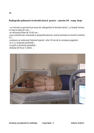 12
Radiografia pulmonară in decubit lateral postero – anterior PA stang- drept
- se execută cu pacientul pe masa de radiografiat în decubit lateral , cu brațele întinse,
cu fața la tubul de raze ;
-se utilizează filme de 35/43 cm ;
-raza centrală este orizontală și perpendiculară pe centrul sternului la nivelul vertebrei
T7 ;
-centrarea se realizează folosind reperul celor 10 cm de la crestatura jugulară ;
-la a 2 a respirație profundă ;
-cu grila și protecție gonadală ;
-distanța de focar 2 metrii ;
Incidențe și poziționări în radiologie Copyright © Zaharia Tudorel
 