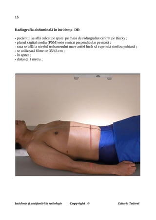 15
Radiografia abdominală în incidența DD
- pacientul se află culcat pe spate pe masa de radiografiat centrat pe Bucky ;
- planul sagital mediu (PSM) este centrat perpendicular pe masă ;
- raza se află la nivelul trohanterului mare astfel încât să cuprindă simfiza pubiană ;
- se utilizează filme de 35/43 cm ;
- în apnee ;
- distanța 1 metru ;
Incidențe și poziționări în radiologie Copyright © Zaharia Tudorel
 