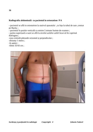 16
Radiografia abdominală cu pacientul in ortostatism PA
- pacientul se află in ortostatism la stativul aparatului ,cu fața la tubul de raze ,centrat
pe Bucky ;
- pacientul în pozitie verticală cu minim 5 minute înainte de examen ;
- partea superioară a razei se află la nivelul axilelor astfel încat să fie cuprinsă
diafragma ;
-raza centrală pătrunde orizontal și perpendicular ;
-distanța 1 metru ;
-în apnee ;
-filme 35/43 cm ;
Incidențe și poziționări în radiologie Copyright © Zaharia Tudorel
 