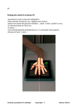 17
Radiografia mâinii în incidența PA
-pacientul pe scaun la masa de radiografiat ;
-mâna afectată centrată pe raza , degetele ușor extinse ;
-planul este format din procesul stiloidian , radial si ulnar paralel cu raza ;
-se utilizează filme de 18/24 cm ;
-în apnee ;
-raza centrală pătrunde perpendicular în a 3 a articulație metacarpiană ;
-distanța de focar 1 metru ;
Incidențe și poziționări în radiologie Copyright © Zaharia Tudorel
 