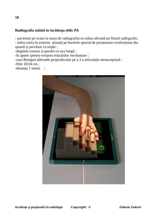 18
Radiografia mâinii în incidența oblic PA
- pacientul pe scaun la masa de radiografiat cu mâna afectată pe filmul radiografic;
- mâna rotita în exterior plasată pe buretele special de poziționare confecționat din
spumă și prevăzut cu trepte ;
-degetele extinse și paralel cu axa lungă ;
-în apnee /pentru evitarea mișcărilor involuntare ;
-raza Rontgen pătrunde perpendicular pe a 3 a articulație metacarpiană ;
-film 18/24 cm ;
-distanța 1 metru ;
Incidențe și poziționări în radiologie Copyright © Zaharia Tudorel
 