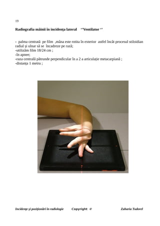 19
Radiografia mâinii în incidența lateral ‘’Ventilator ‘’
- palma centrată pe film ,mâna este rotita în exterior astfel încât procesul stiloidian
radial și ulnar să se încadreze pe rază;
-utilizăm film 18/24 cm ;
-în apnee;
-raza centrală pătrunde perpendicular în a 2 a articulație metacarpiană ;
-distanța 1 metru ;
Incidențe și poziționări în radiologie Copyright © Zaharia Tudorel
 
